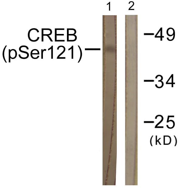CREB1 / CREB Antibody (phospho-Ser121)