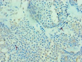 MICA Antibody (aa24-307)