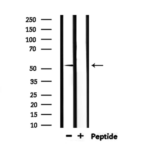 NR0B1 / DAX1 Antibody