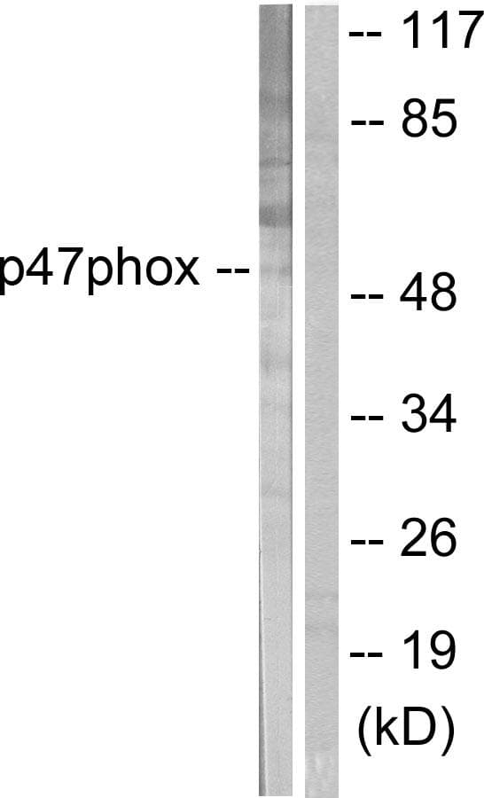NCF1 / p47phox / p47 phox Antibody (p359)