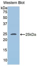 PLIN2 / ADFP / Adipophilin Antibody (aa245-433)