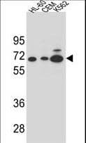 Polyclonal Rabbit anti-Human AMY2B Antibody (aa74-100, IHC, IF, WB)