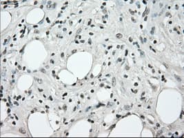 Monoclonal Mouse anti-Human BRAF / B-Raf Antibody (clone OTI4G6, IHC, WB)