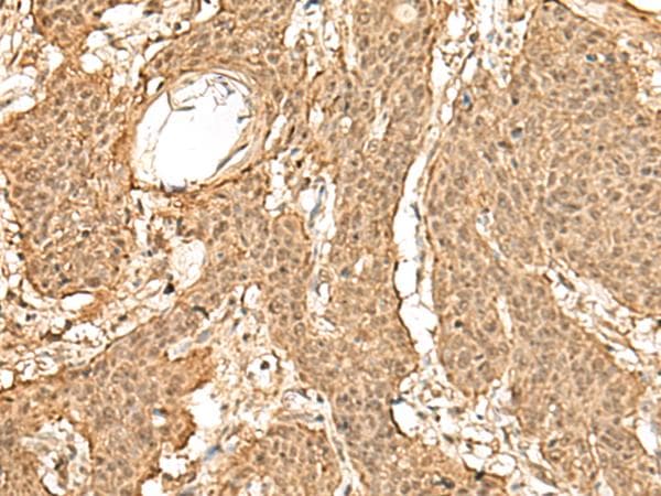 TIPRL / TIP Antibody