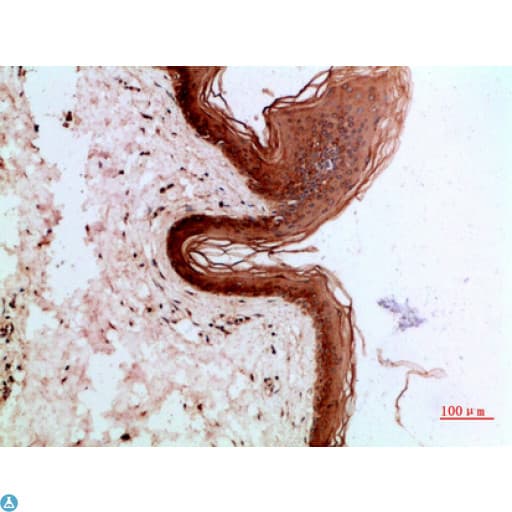 Polyclonal Rabbit anti-Human KRT14 / CK14 / Cytokeratin 14 Antibody (WB)