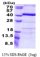 Human ANKRD54 / LIAR Protein (Recombinant His)