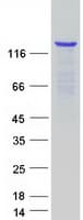 Human KDM4A / JHDM3A / JMJD2A Protein (Recombinant Myc-DDK (Flag))