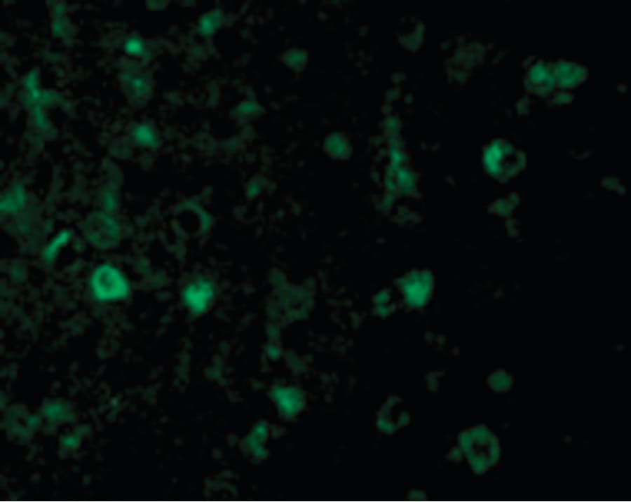 IHC-plus™ RHEB Antibody