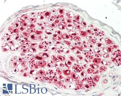 TUBB4 / Tubulin Beta 4 Antibody (clone 3C12, Carrier-free)
