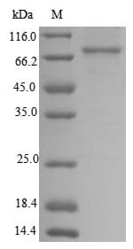 Human NRROS / LRRC33 Protein (Recombinant 10His, N-terminus + Myc, C-terminus)