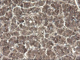 Monoclonal Mouse anti-Human PNPO Antibody (clone OTI1G9, IHC, WB)