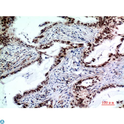 Polyclonal Rabbit anti-Human TP53INP2 Antibody (IHC, WB)