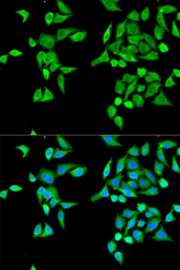CES2 / Esterase Antibody
