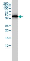 ACTR3 Antibody (clone 2B6)