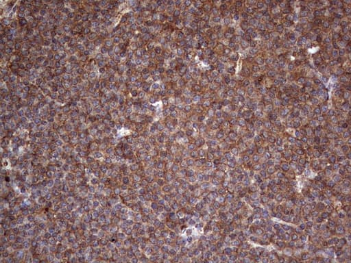 LRRTM1 Antibody (aa182-422, clone OTI1C5)