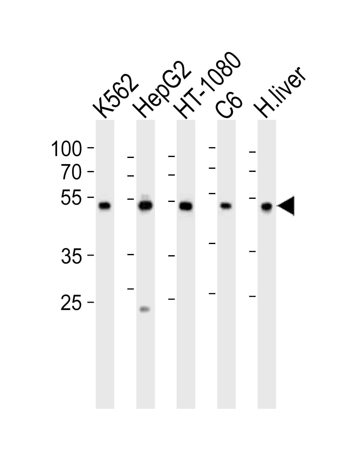PDIA6 / ERP5 Antibody (aa144-172)