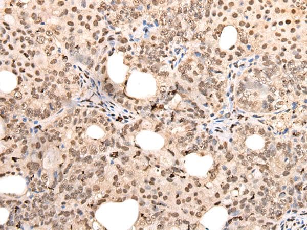 Polyclonal Rabbit anti-Human ZSCAN12 Antibody (IHC)