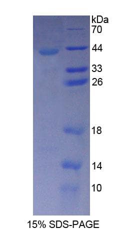 Human TUBA3C / Tubulin Alpha 3C Protein (Recombinant His-T7)