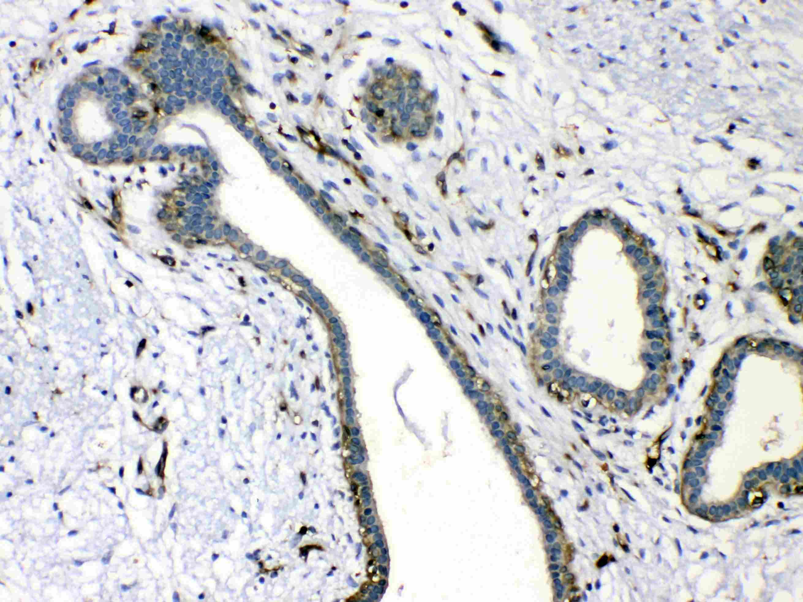 VASP Antibody