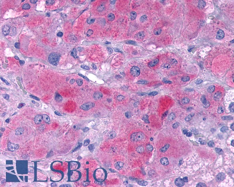 PathPlus™ Polyclonal Rabbit anti-Human GLP1R / GLP-1 Receptor Antibody (N-Terminus, IHC, IF, WB)