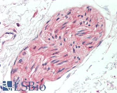 IHC-plus™ Polyclonal Rabbit anti-Human FAM134B Antibody (IHC)