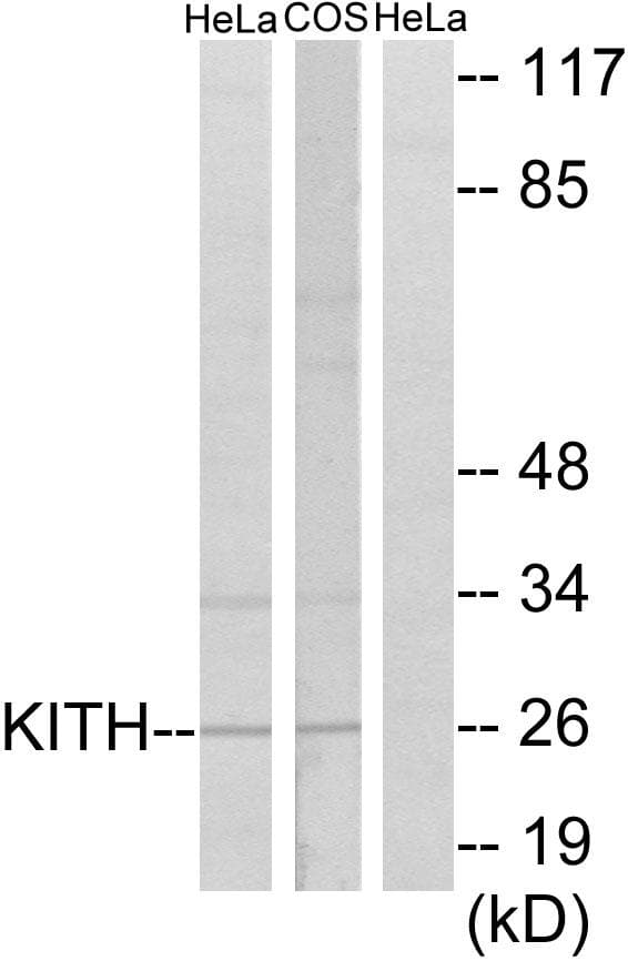 TK1 / TK / Thymidine Kinase Antibody