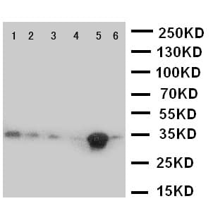 CASP9 / Caspase 9 Antibody (aa183-198)