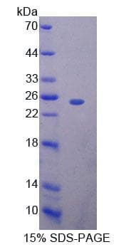 Mouse BAG5 Protein (Recombinant His-T7, N-terminus)