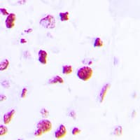 C/EBP Beta / CEBPB Antibody (C-Terminus)