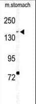 BCOR Antibody (aa1107-1137)