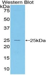 BAX Antibody (aa1-192)