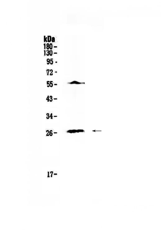 IL17A Antibody