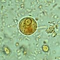 Entamoeba histolytica Antibody (clone EH34.5)
