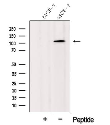 Polyclonal Rabbit anti-Human CASC3 / MLN51 Antibody (WB)