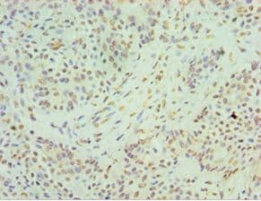 HNRPM / HNRNPM Antibody (aa491-730)