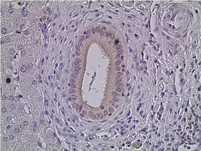 ERK1 + ERK2 Antibody (clone 3F8B3)