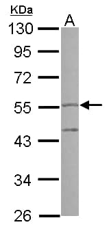 Polyclonal Rabbit anti-Human PI16 Antibody (WB)