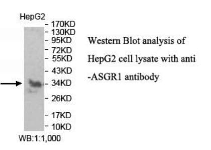 Polyclonal Rabbit anti-Human ASGR1 / ASGPR Antibody (aa96-283, WB)