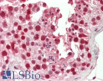 Polyclonal Rabbit anti-Human CBX3 / HP1 Gamma Antibody (aa61-110, IHC, WB)
