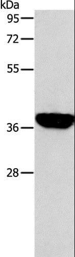 Polyclonal Rabbit anti-Human ALDOB Antibody (IHC, WB)