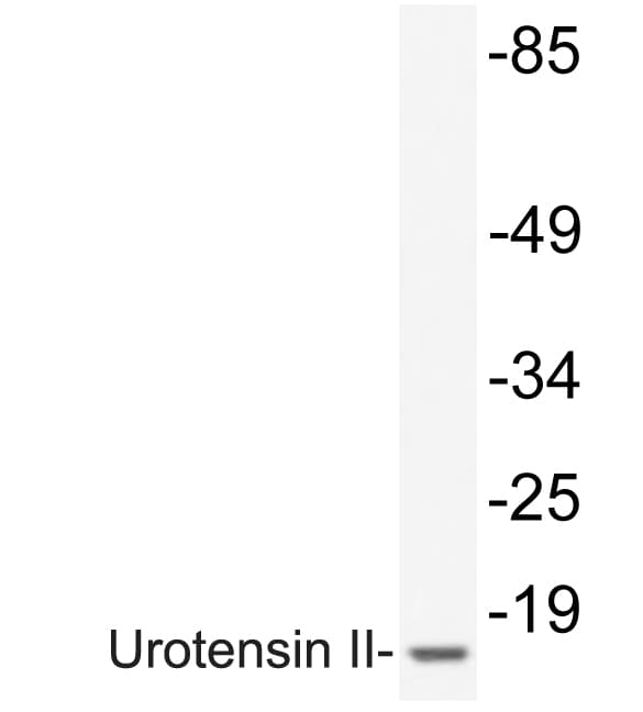 UTS2 / Urotensin II Antibody (aa48-97)