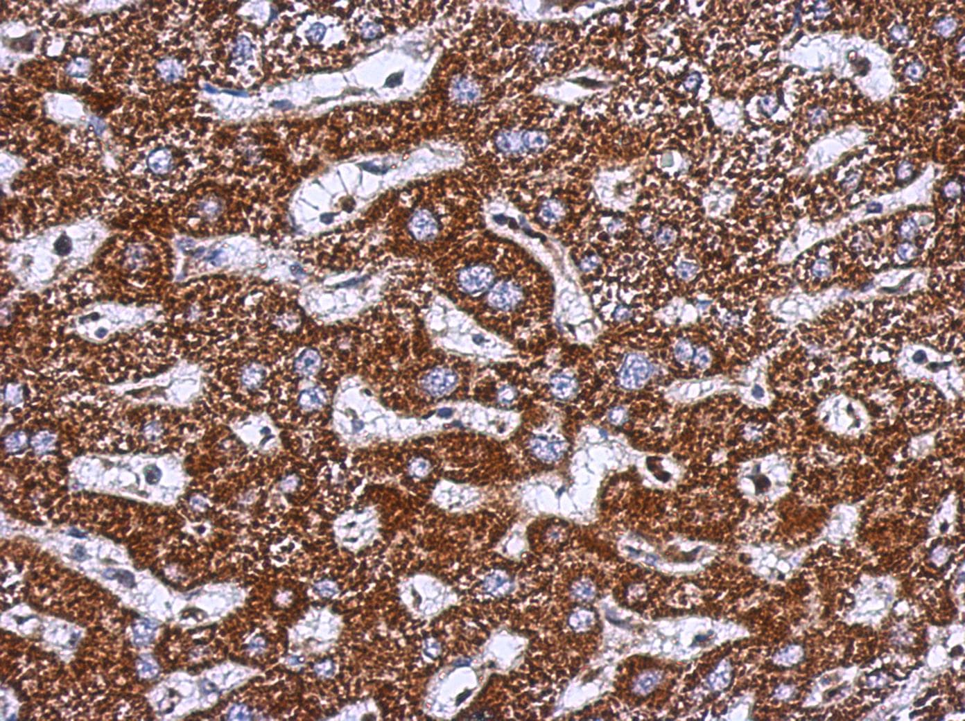 TOM1L1 Antibody (Internal)