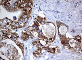 PIK3CD / PI3K Delta Antibody (aa286-610, clone OTI2H3)