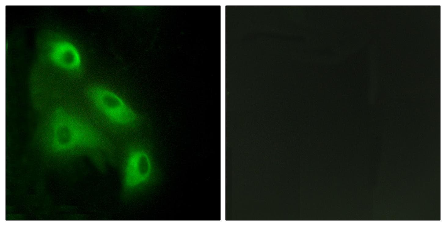 Polyclonal Rabbit anti-Human EPS8L3 Antibody (IHC, IF)