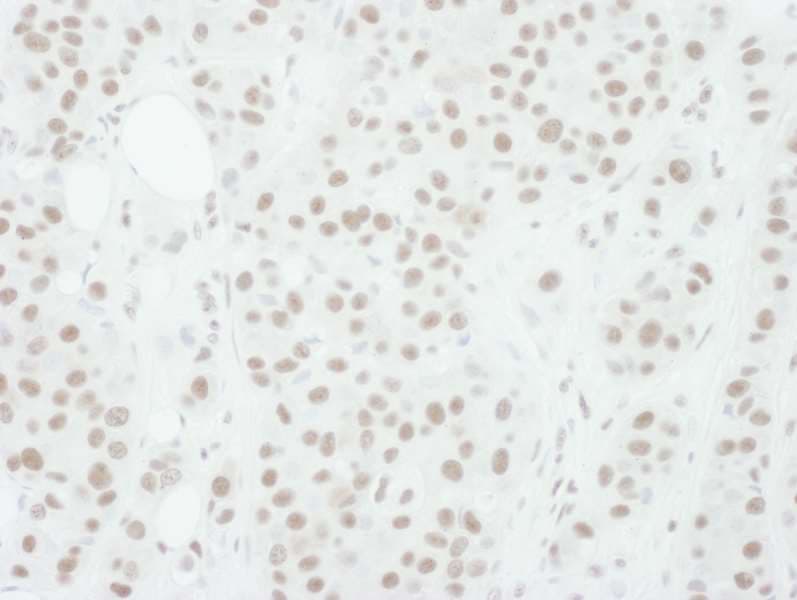 MAP2K1 / MKK1 / MEK1 Antibody (phospho-Thr286)