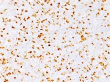 TOP2A / Topoisomerase II Alpha Antibody (clone TOP2A/1362, Azide-free, BSA-free)