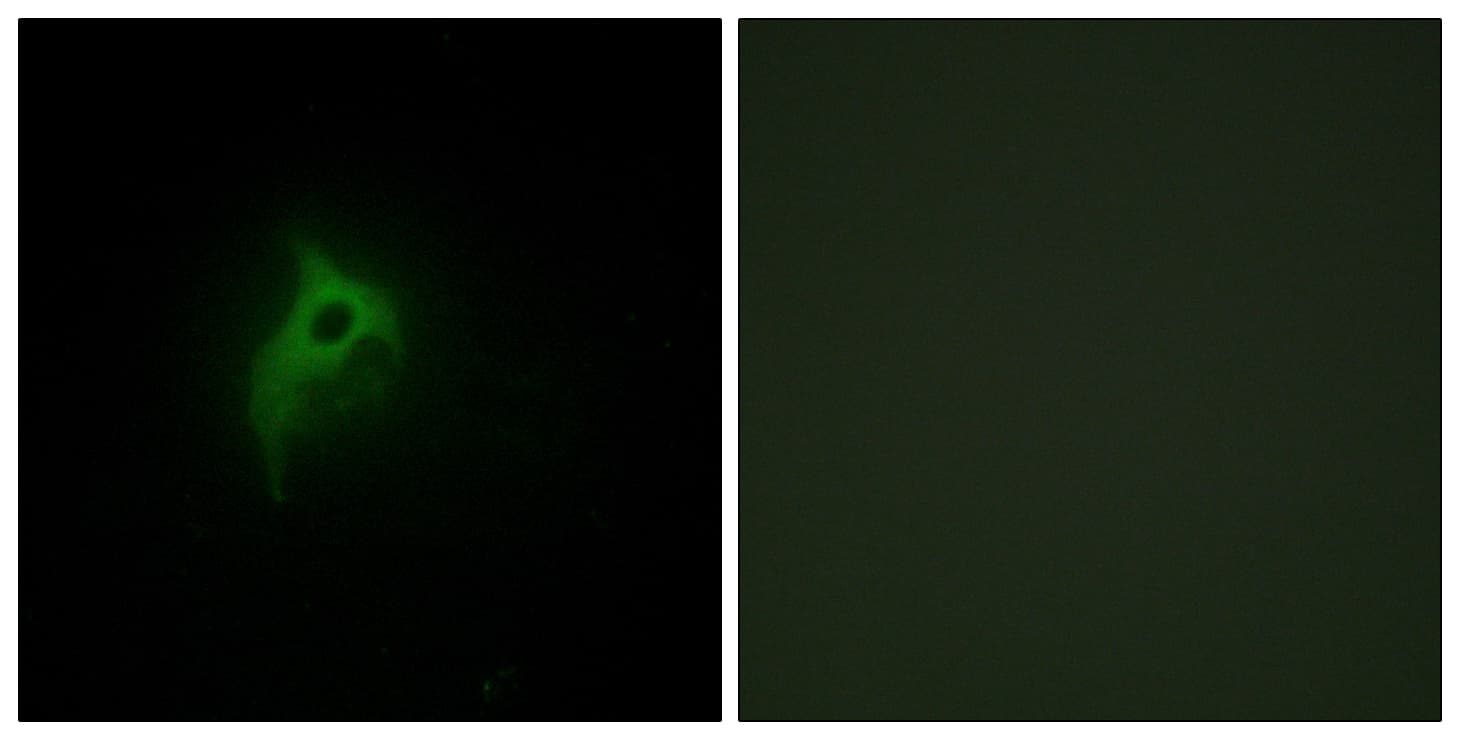 Polyclonal Rabbit anti-Human ADRA2B Antibody (aa161-210, IF)