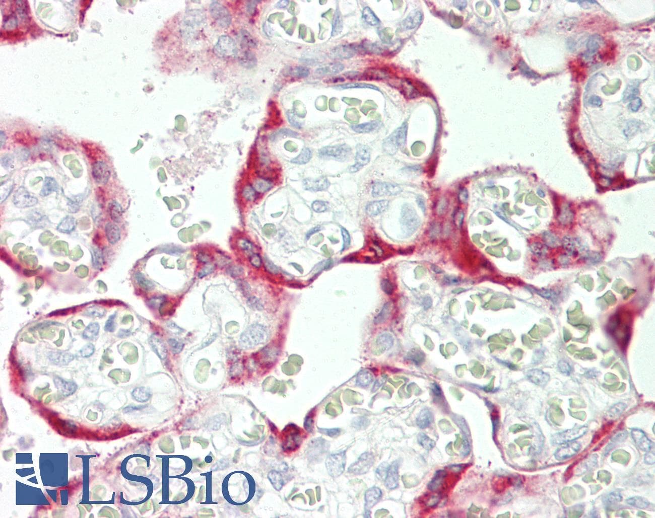 IHC-plus™ GP78 / AMFR Antibody (aa371-400)