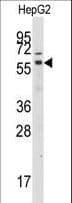 GRK7 / GPRK7 Antibody (aa508-538)