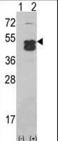 CAMK1D Antibody (aa302-333)